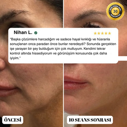 Elvia EMS Güzellik Cihazı