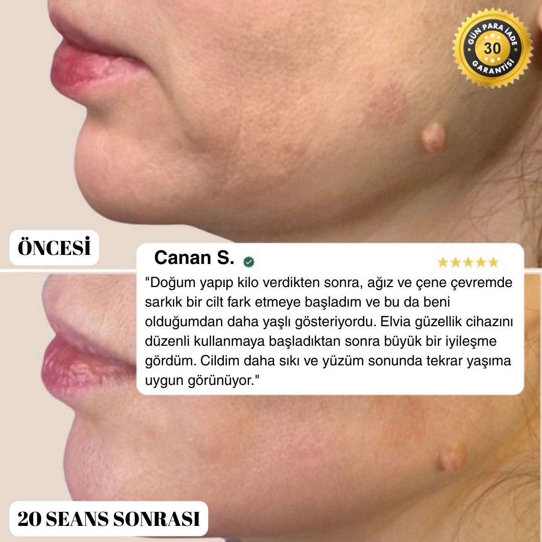 Elvia EMS Güzellik Cihazı