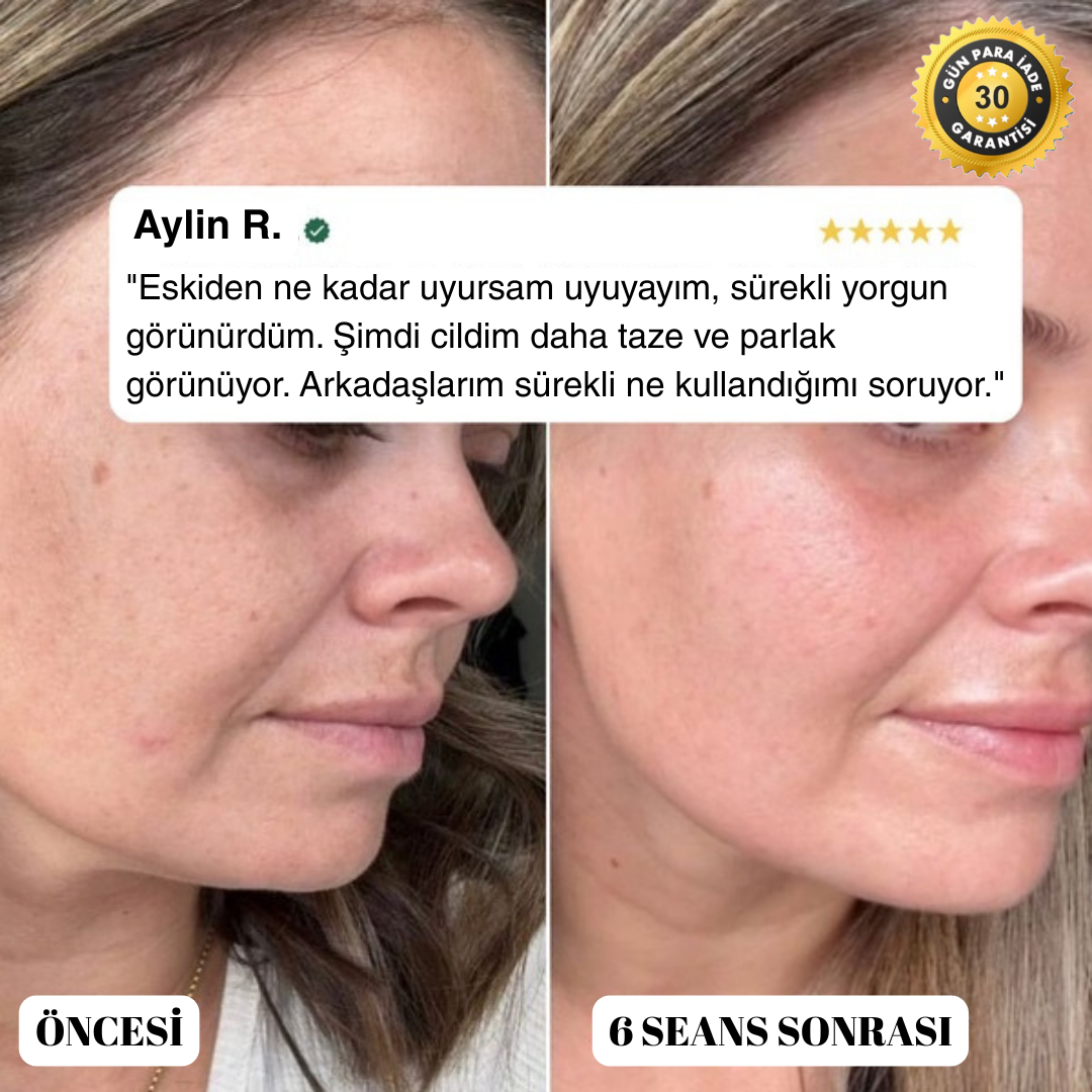 Elvia EMS Güzellik Cihazı